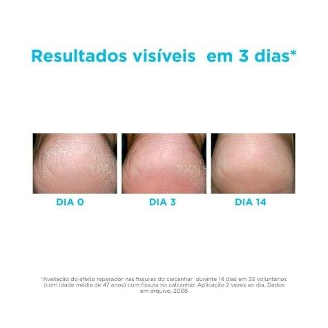 Gel Hidratante Ureadin Podos Pés 75ml - Imagem 3