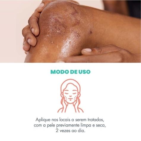 Gel de Cicatrização Avène Cicalfate+ Rosto e Corpo 30ml - Imagem 6