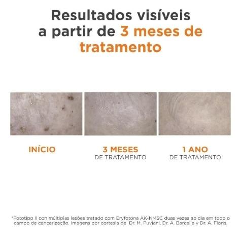 Fluido Protetor Eryfotona AK-NMSC FPS99 50ml - Imagem 4