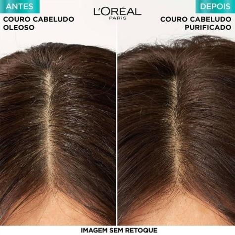 Shampoo Elseve Pure Hialurônico 200ml - Imagem 3