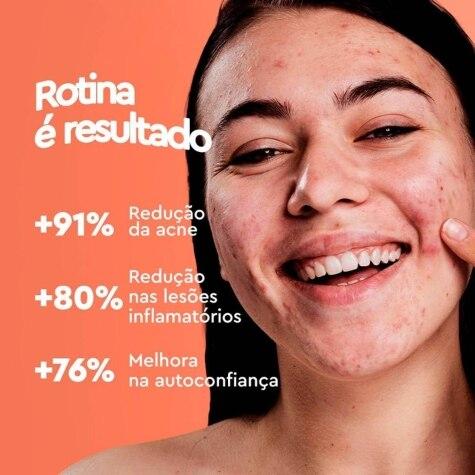 Sabonete em Barra Acnezil Fórmula Forte 90g - Imagem 2
